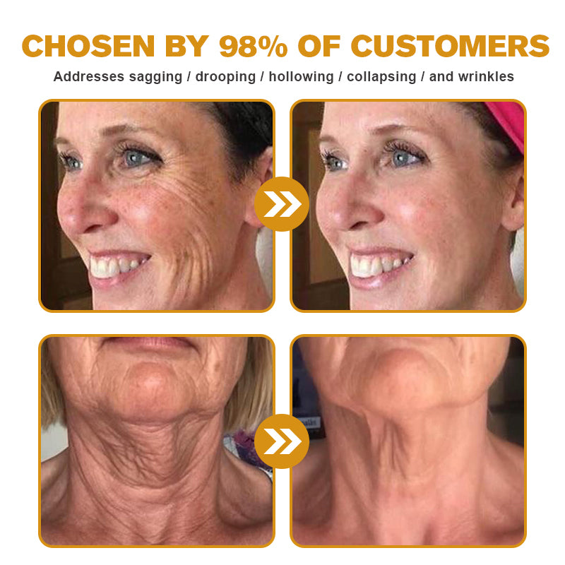 💫🍀Made and Shipped from the USA ✅Furzero™ Botox Bee Venom Wrinkle Removal Cream-Last Day Promotion 70% OFF