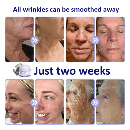 🎁Made and Shipped from USA✨Flysmus® AH-8 Firming Cream🔥LAST DAY 70% OFF