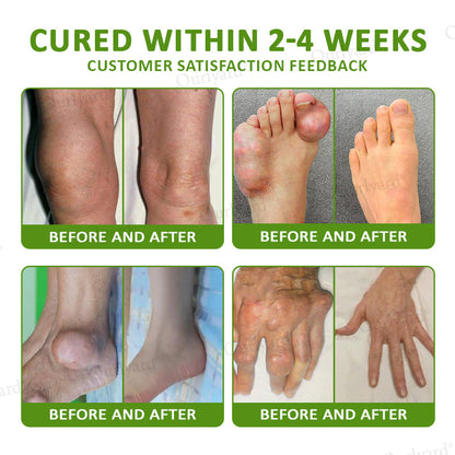 👨‍⚕️☘️Made and Shipped from the USA✅Ourlyard® Magnesium & Peppermint Arthritis Pain Relief and Bone Healing Cream(✅Quick and lasting solution to arthritis, rheumatism, muscle spasms, sports injuries) 🔥LAST DAY 70% OFF