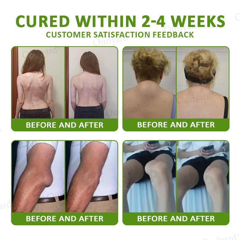 👨‍⚕️☘️Made and Shipped from the USA✅Ourlyard® Magnesium & Peppermint Arthritis Pain Relief and Bone Healing Cream(✅Quick and lasting solution to arthritis, rheumatism, muscle spasms, sports injuries) 🔥LAST DAY 70% OFF