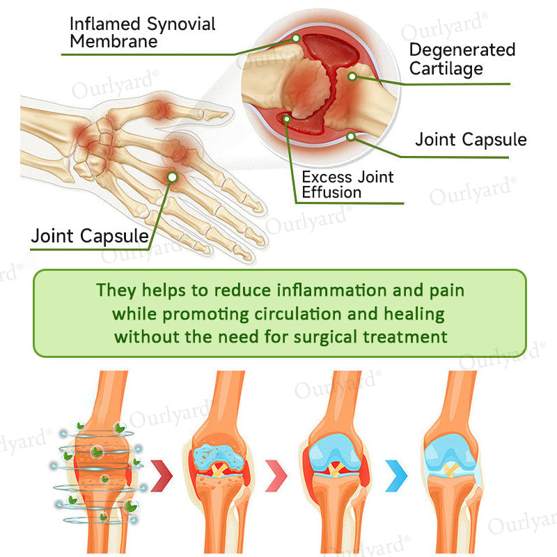 👨‍⚕️☘️Made and Shipped from the USA✅Ourlyard® Magnesium & Peppermint Arthritis Pain Relief and Bone Healing Cream(✅Quick and lasting solution to arthritis, rheumatism, muscle spasms, sports injuries) 🔥LAST DAY 70% OFF