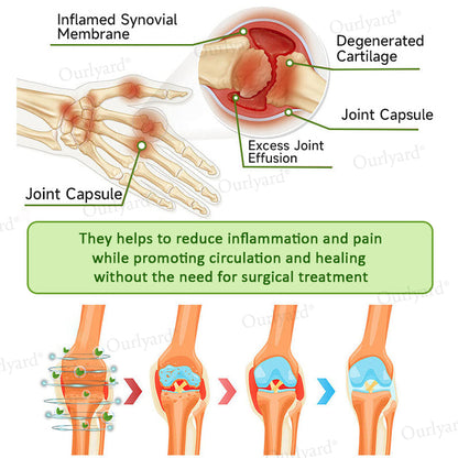 👨‍⚕️☘️Made and Shipped from the USA✅Ourlyard® Magnesium & Peppermint Arthritis Pain Relief and Bone Healing Cream(✅Quick and lasting solution to arthritis, rheumatism, muscle spasms, sports injuries) 🔥LAST DAY 70% OFF
