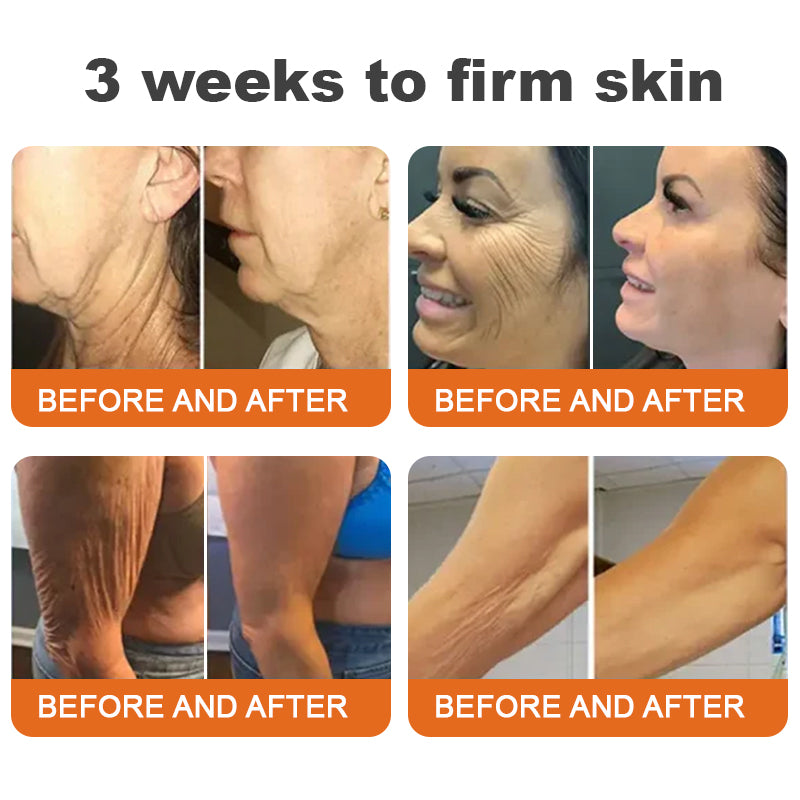 💎💃💃Made and Shipped from the USA✨Flysmus™ Botox Bee Venom Firming Serum Stick🔥LAST DAY 70% OFF