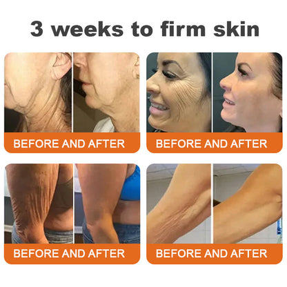 💎💃💃Made and Shipped from the USA✨Flysmus™ Botox Bee Venom Firming Serum Stick🔥LAST DAY 70% OFF