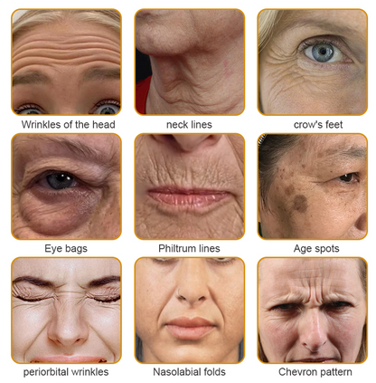 💫🍀Made and Shipped from the USA ✅Furzero™ Botox Bee Venom Wrinkle Removal Cream-Last Day Promotion 70% OFF