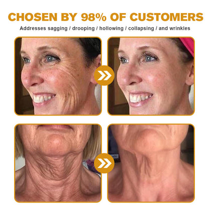 💫🍀Made and Shipped from the USA ✅Furzero™ Botox Bee Venom Wrinkle Removal Cream-Last Day Promotion 70% OFF