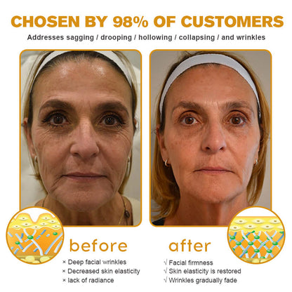 💫🍀Made and Shipped from the USA ✅Furzero™ Botox Bee Venom Wrinkle Removal Cream-Last Day Promotion 70% OFF